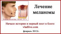 О лечении меланомы. Часть1. Россия. Сентябрь 2011 T2N0M0. Первая запись в блоге о лечении меланомы. 2012г