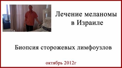Лечение меланомы. Биопсия сторожевых лимфатических узлов. Отзыв.
