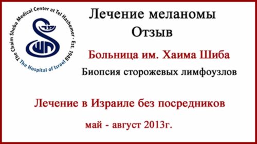 Лечение в Израиле без посредников. История лечения меланомы в больнице Шиба