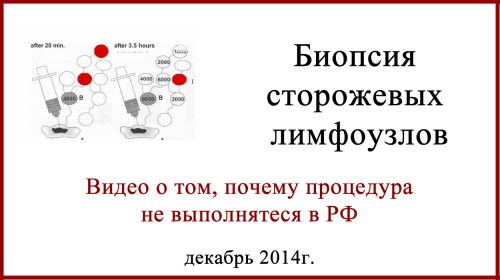 Биопсия сторожевых лимфоузлов Видео