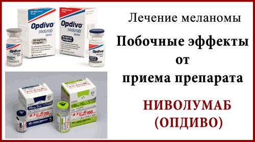 Ниволумаб (Опдиво). Побочные эффекты