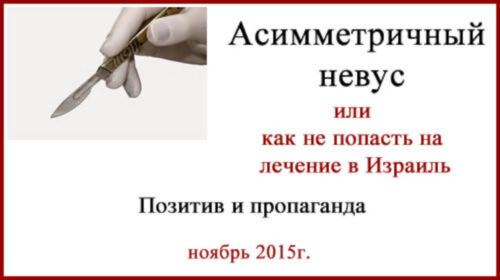Асимметричный невус. Как не попасть на лечение в Израиль. Позитив и пропаганда. Асимметричный невус, или как не попасть на лечение в Израиль