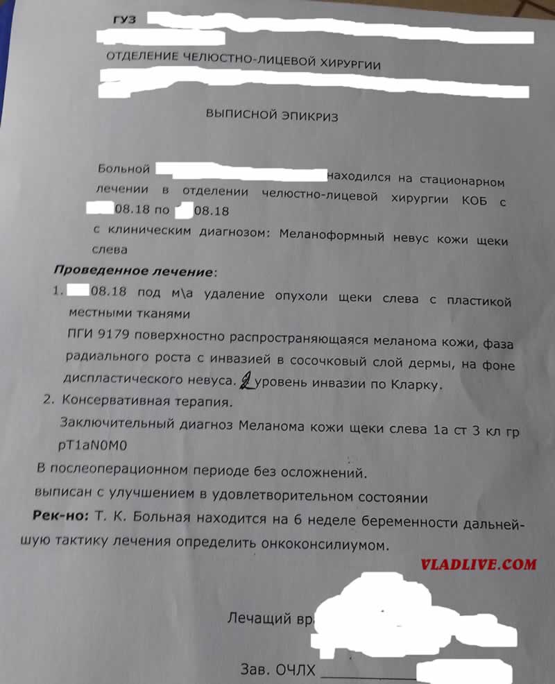 Меланома и беременность. Меланома у беременных