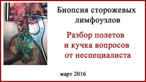Биопсия сторожевых лимфоузлов. Вопросы и разбор полётов. Странная биопсия сторожевых лимфоузлов. Клинический случай