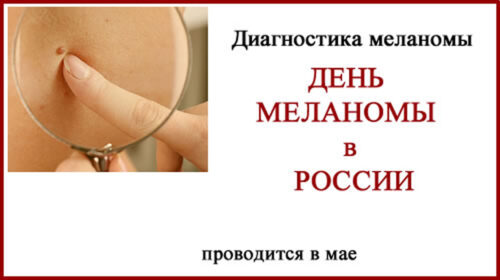 День меланомы в России