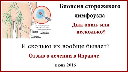 Биопсия сторожевого лимфоузла. Отзыв о лечении в Израиле