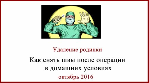 После удаления родинки как снять швы в домашних условиях? Как снять швы в домашних условиях
