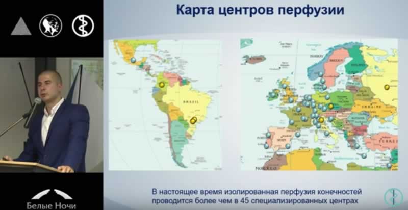 Перфузия конечностей - применение в мире
