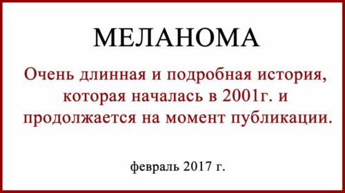 История о лечении меланомы