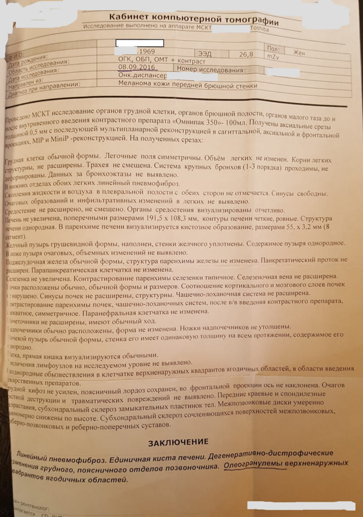Меланома КТ