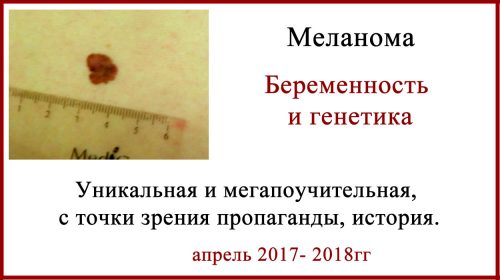 История меланома и беременность