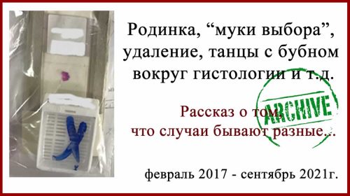 Меланома или невус? Пересмотр гистологии в Израиле