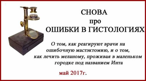 Меланома лечение. Ошибки гистологии