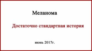 Меланома достаточно стандартная история