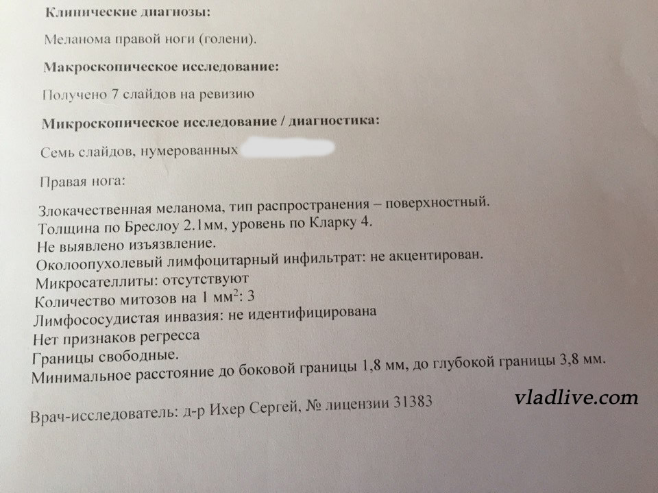 Меланома. Гистология в Израиле Биопсия сторожевых лимфоузлов История. Гистология в Израиле