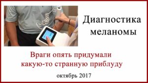 DermaSensor - диагностика меланомы