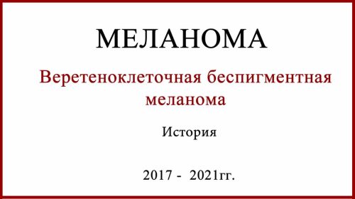 Веретеноклеточная беспигментная меланома