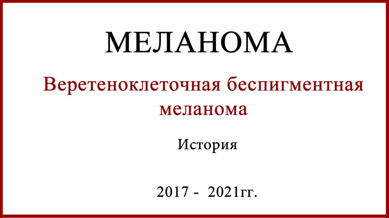Лечение меланомы. История развития болезни + КИ по BCD-100. Веретеноклеточная беспигментная меланома