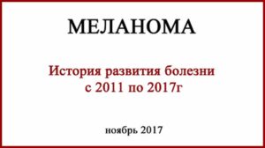 Меланома История