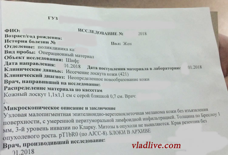Меланома . Гистологическое исследование Меланома . Гистологическое исследование