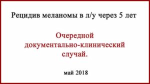 Метастаз в лимфоузел. Меланома