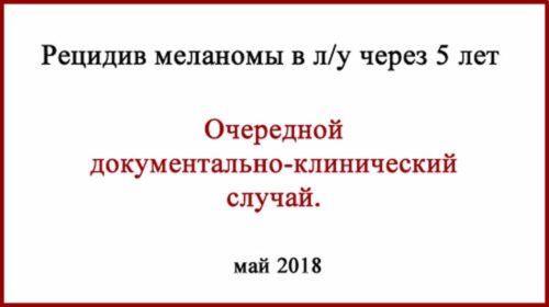 Метастаз в лимфоузел. Меланома