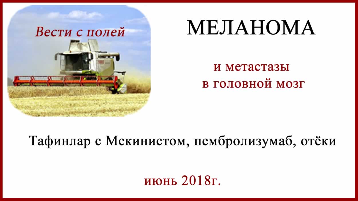 Меланома и метастазы в головной мозг Меланома и метастазы в головной мозг