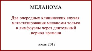 случаи метастазирования меланомы