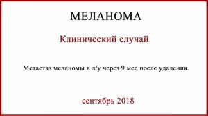 Метастаз в лимфоузел после удаления меланомы 0,5-0,7 мм