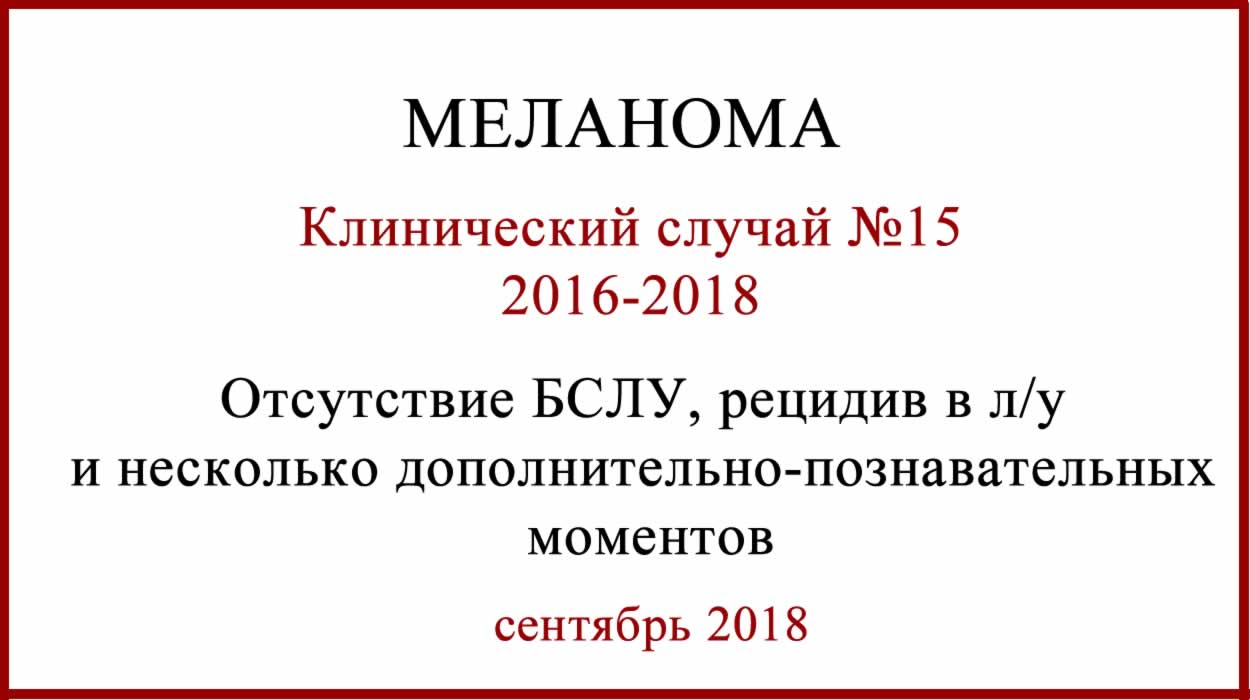 Меланома. Метастаз в лимфоузел через год Меланома Метастаз в лимфоузел через год