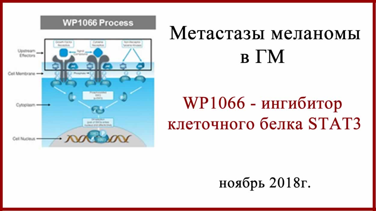 WP1066 новый препарат для лечения метастазов меланомы в ГМ WP1066 - лечение метастазов меланомы в головном мозге