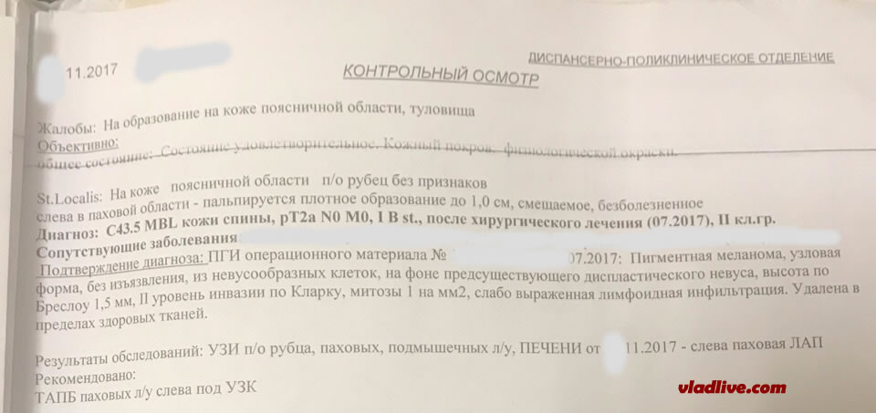 Меланома. Метастазы Меланома. Метастазы