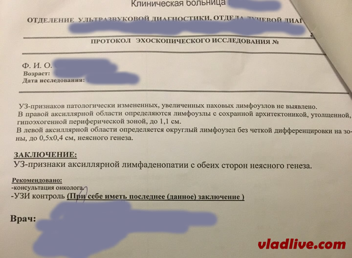 Меланома. УЗИ лимфозулов Меланома. УЗИ лимфозулов