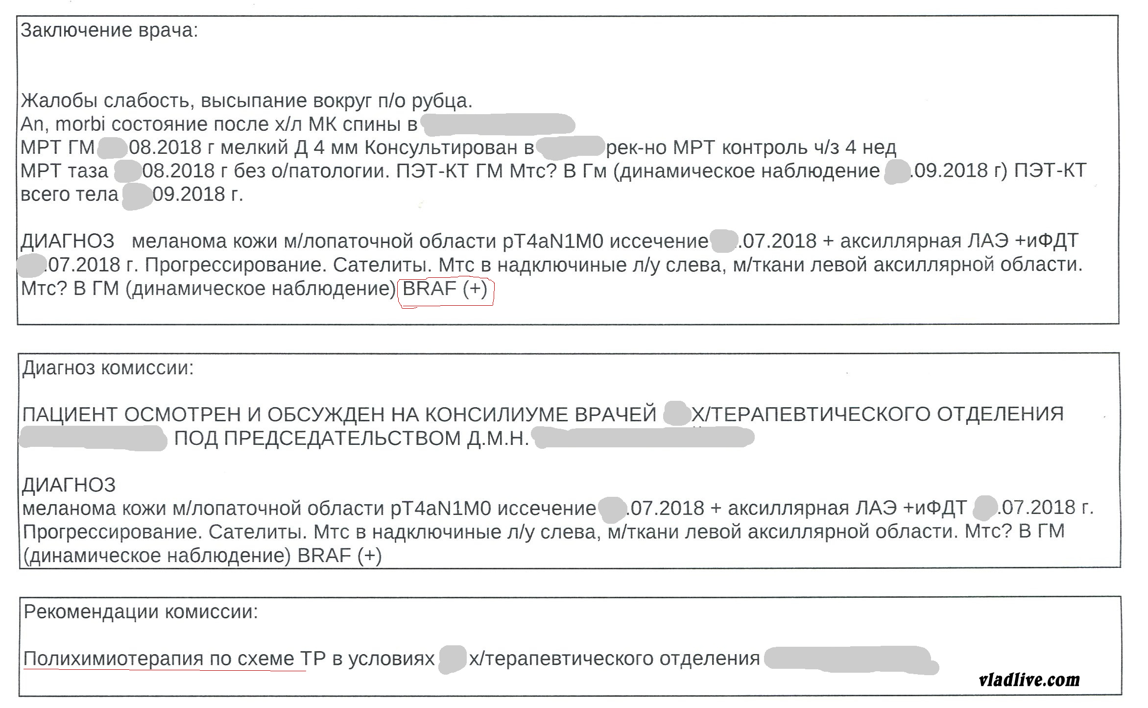 Лечение меланомы в России