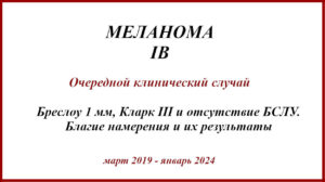 Меланома IB. История лечения