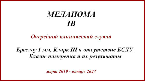 Меланома IB. История лечения