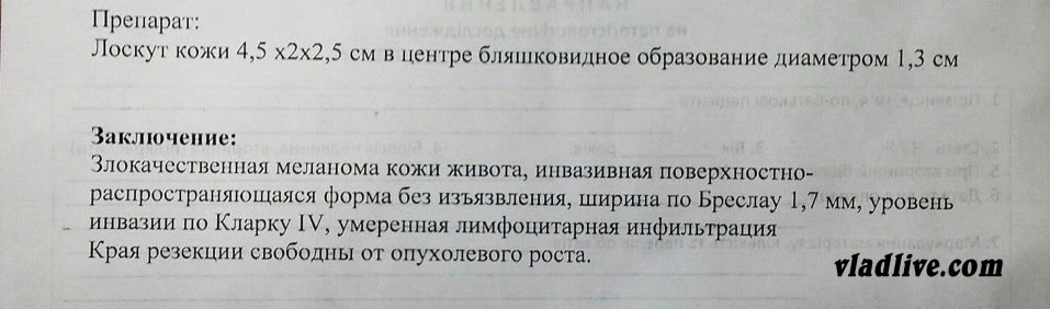 Меланома. Гистология Меланома гистология. ФОТО