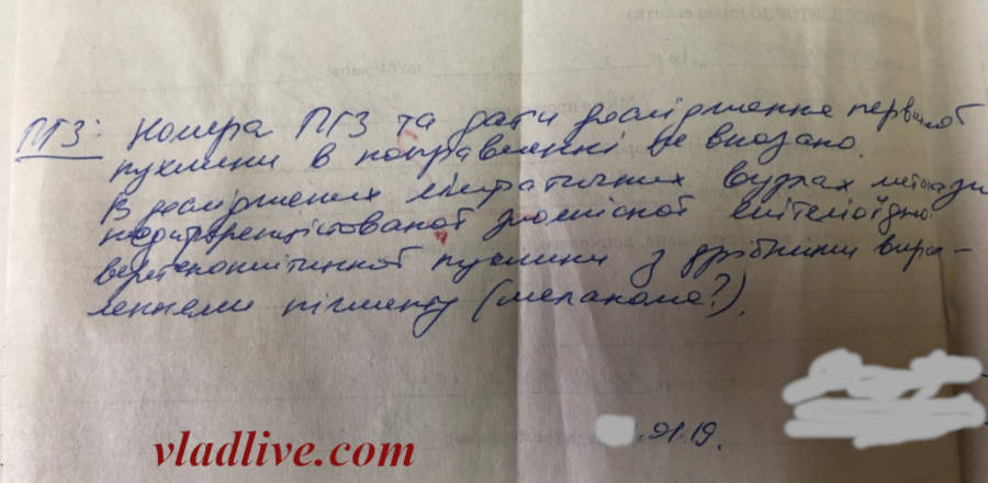 Метастазы меланомы в лимфоузлах
