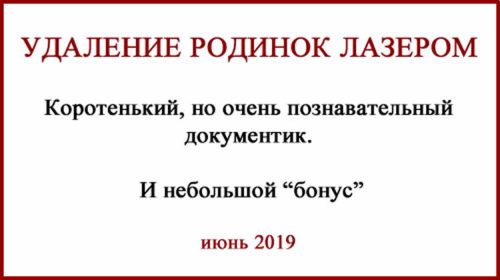 Гистология после удаления родинок лазером фото