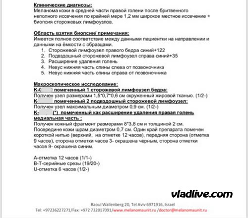 Истории лечения в Израиле. Гистология удаленных сторожевых лимфоузлов