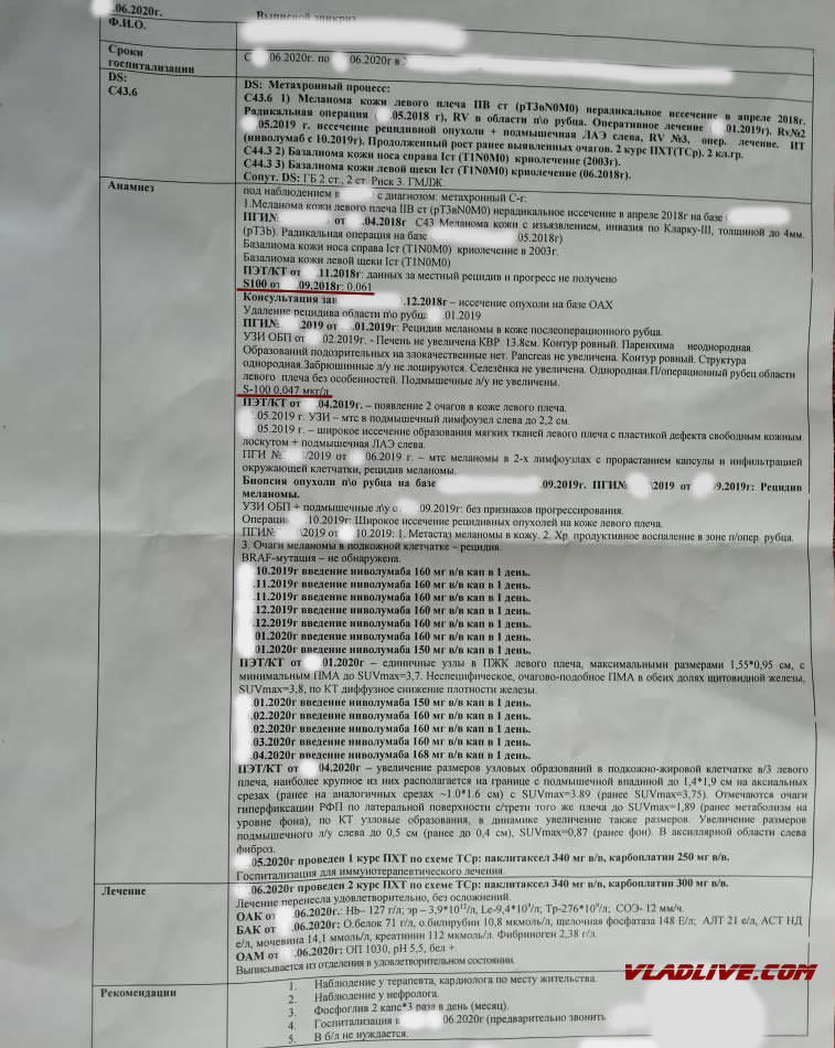 Лечение меланомы