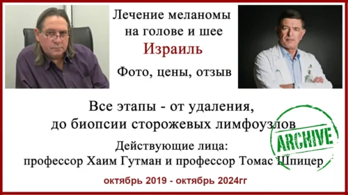 Меланома на ухе. Лечение меланомы в Израиле Отзыв