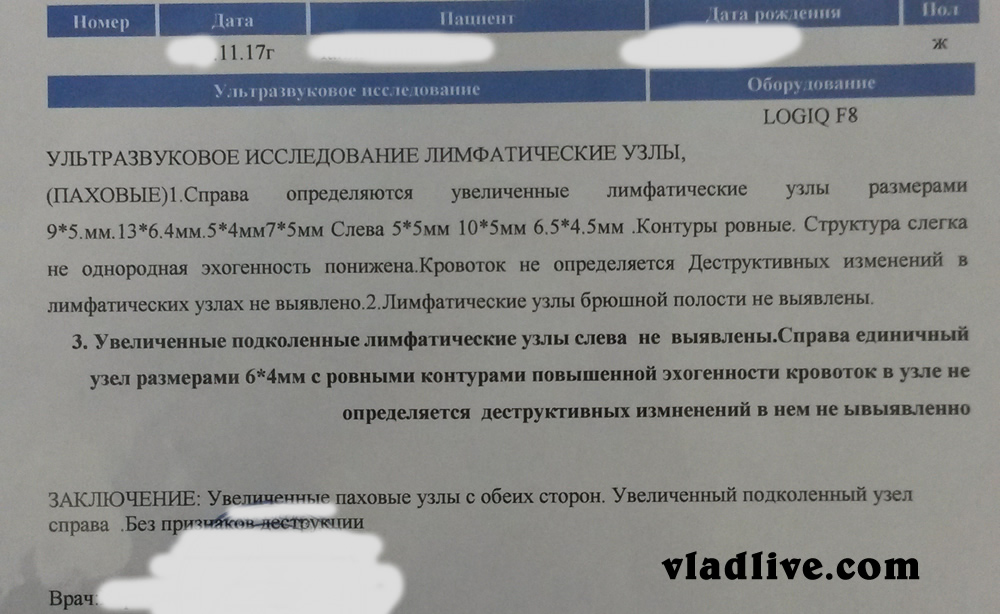 Меланома история лечения - УЗИ лимфоузлов