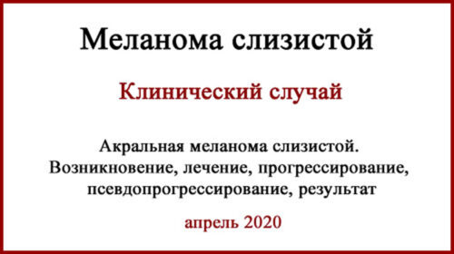 Лечение меланомы слизистой в Израиле