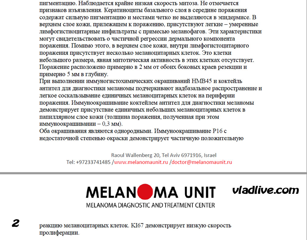 Пересмотр гистологии в Израиле. невус Спарк (SPARK)