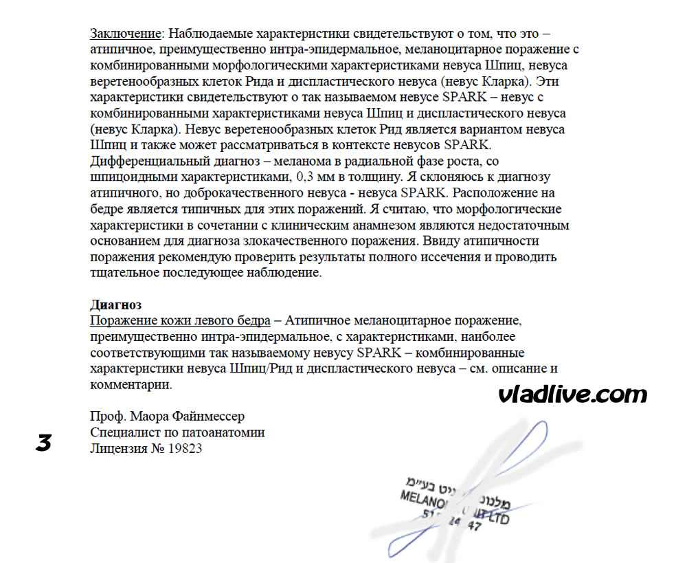 Меланома. Ревизия гистологии в Израиле. Невус Спарк (SPARK). Профессор Маора Файнмессер