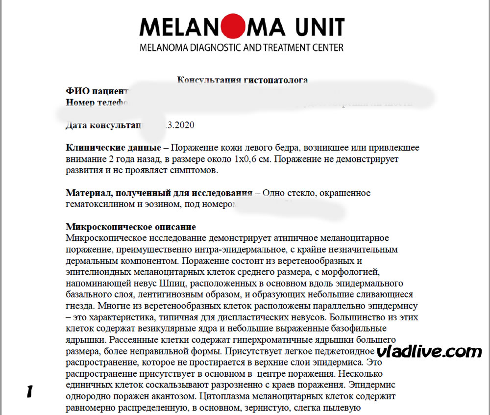 Ревизия гистологии в Израиле. невус Спарк (SPARK)