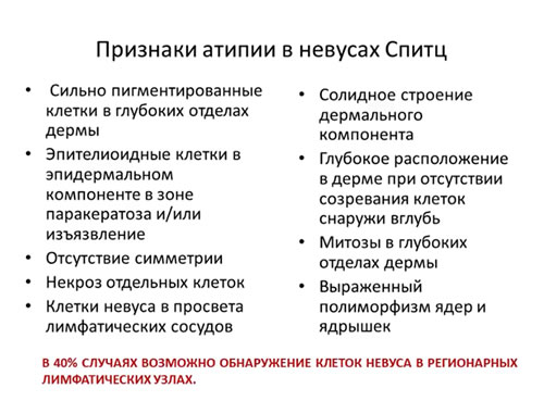 Шпиц невус