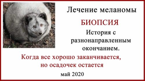 Лечение меланомы в России. Биопсия или лимфодиссекция?