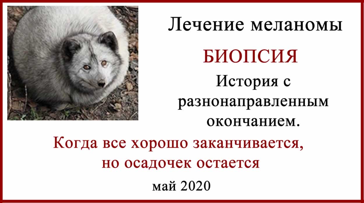 Меланома. Биопсия. Короткая, но захватывающая история. Лечение меланомы в России. Биопсия или лимфодиссекция?